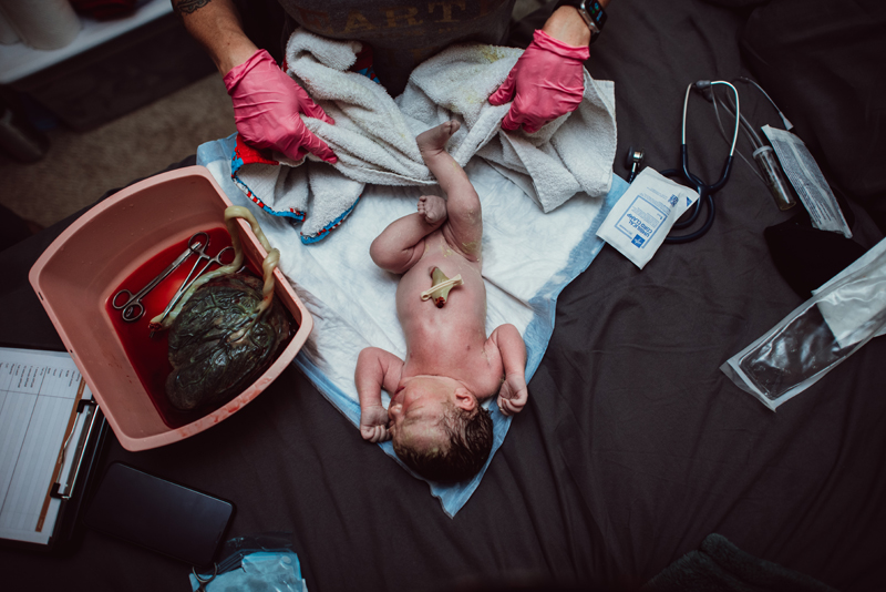 Birth Photography -new baby lays on bed with umbilical cord cut and placenta in bowl nearby