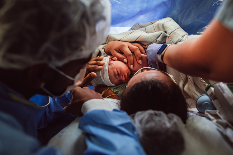 Birth Photography - Surgery team admires a newborn baby as she's comfortable in mom's arms