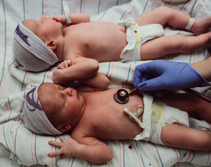 Birth Photography - two newborn siblings with arms intertwines lay in on blanket being examined by physician