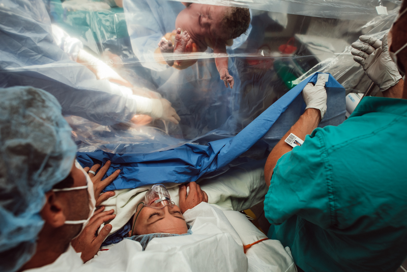 baby is lifted over clear drape in cesarean operating room