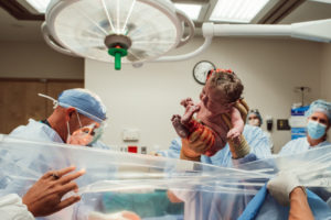 baby lifted during cesarean birth